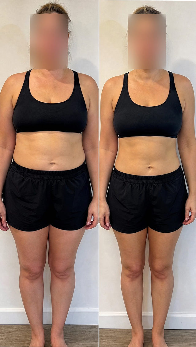 Before and after — Less water retention through the middle — visibly lighter.