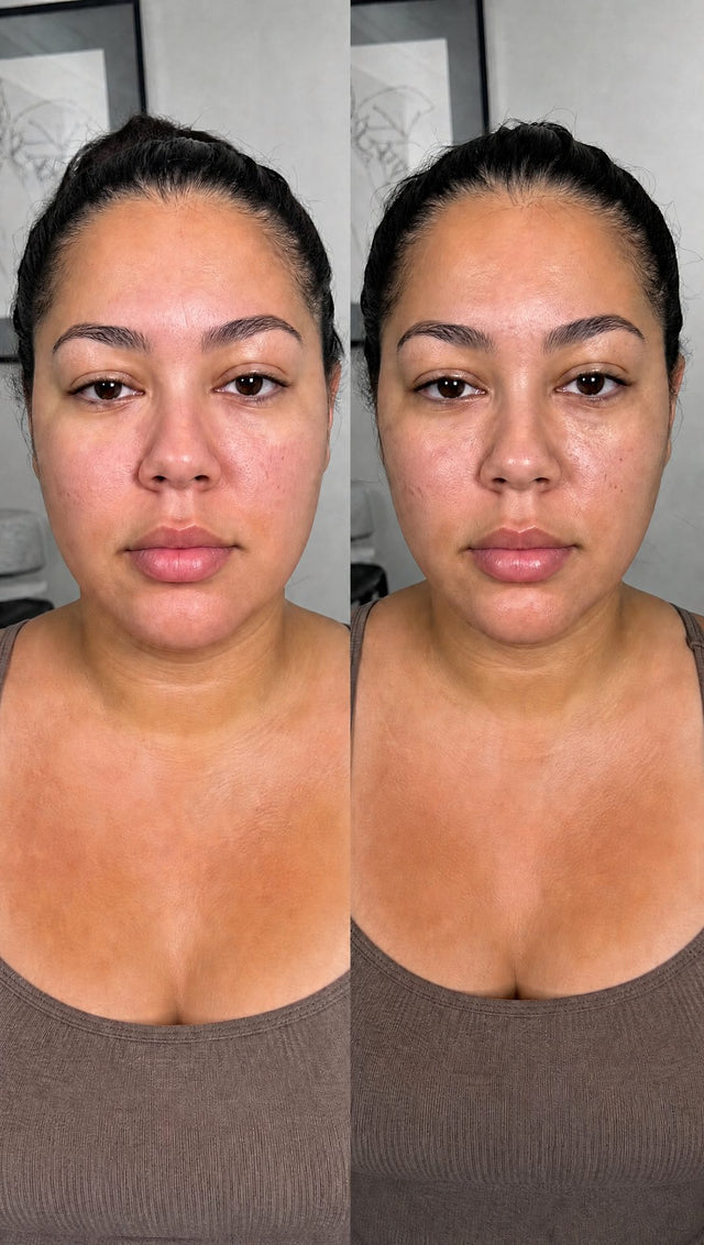 Before and after — Cheeks and jaw de-puffed — two weeks of evenings.